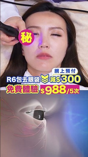 眼袋真係無得救？R6去眼袋療程【免費體驗】🔥一次見效🔥針對 | 眼袋 | 淚溝凹陷 | 眼周鬆弛 | 黑眼圈顯老