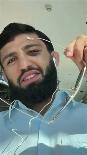 Is Arman Tsarukyan's eye okay? 😳