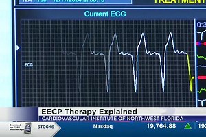 Medical Monday: EECP Therapy explained - NewsBreak