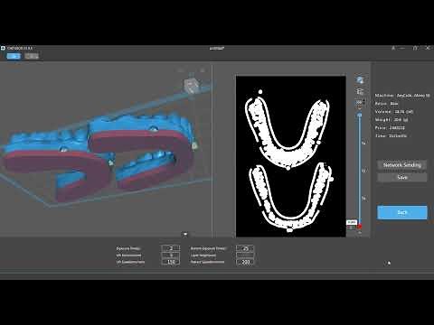 Chitubox Slicer - Hollowing a Solid Dental Model