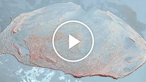 Extracellular Matrix