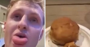 Man gets stung by bee while eating burger, his tongue swells up disturbingly [WATCH]