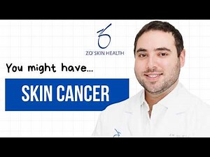 The 3 Main Skin Cancers and How to Spot Them