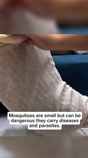 Mommy Marie | Elephantiasis (lymphatic filariasis) is a parasitic disease caused by filarial worms transmitted by mosquitoes, which damage the lymphatic... | Instagram