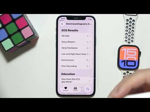 Does Apple Watch Detect Atrial Fibrillation (AFiB)?