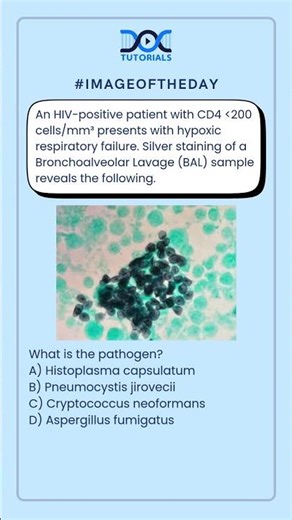 What is the pathogen?