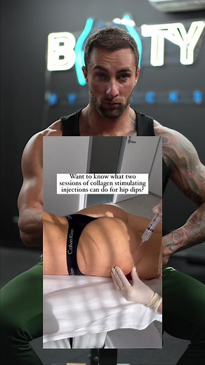 The Rise of Butt Injections: Is This the New Norm?