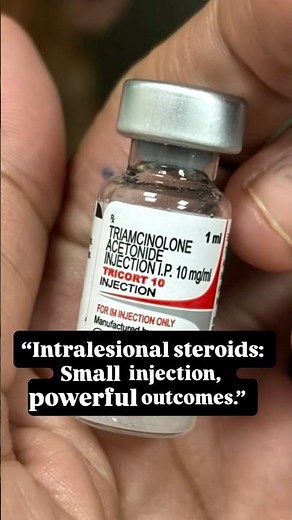 Intralesional Steroids