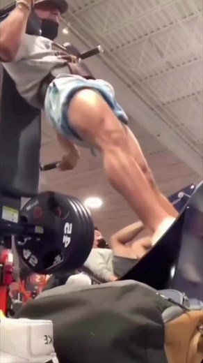 Locking out your knees during exercises sucn as the hack squat or leg press can put a lot of stress on the knee joint, including the ACL, PCL, LCL, and MCL. This can increase the risk of injury to these important knee stabilizing ligaments. Maintaining proper form and control throughout the entire range of motion of the exercise is important to avoid putting NTIALLY unnecessary stress on the knee joint and reduce the risk of injury. Engaging the quadriceps and glutes can also help support the kn