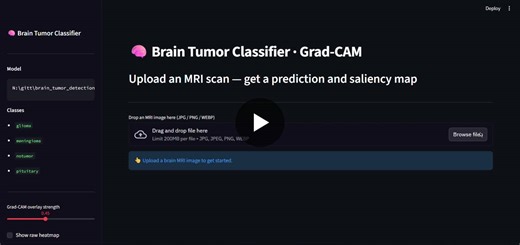 Automating MRI Tumor Classification with Explainable AI | Nishit Patel posted on the topic | LinkedIn