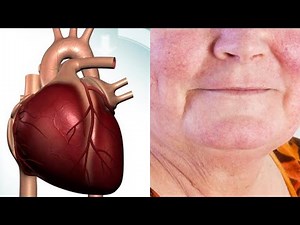 METOPROLOL (Lopressor,Toprol XL) SIDE EFFECTS, USES