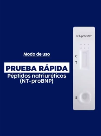 La prueba rápida de NT-proBNP es un inmunoensayo cromatográfico de flujo lateral para la detección cualitativa de NTproBNP en muestras de sangre entera/capilar, suero o plasma. Auxiliar en el diagnóstico de insuficiencia cardíaca. ¿Le interesa formar parte de nuestra gran comunidad de médicos 👨🏻‍⚕️👩🏻‍⚕️de todo el país? Contáctenos será un placer brindarle el acceso a nuestra gran comunidad de médicos. Acceso a nuestras próximas conferencias gratuitas ⬇️ 💬 WhatsApp: 222 963 5727 📲 Teléfono: