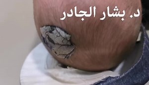 Understanding Knee Injuries and First Aid Tips