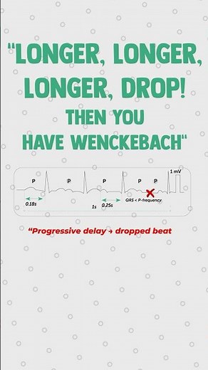 Heart Blocks made easy with this Poem 🫀✍️#medstudent #medschool #usmlestep1 #usmle #cardiology
