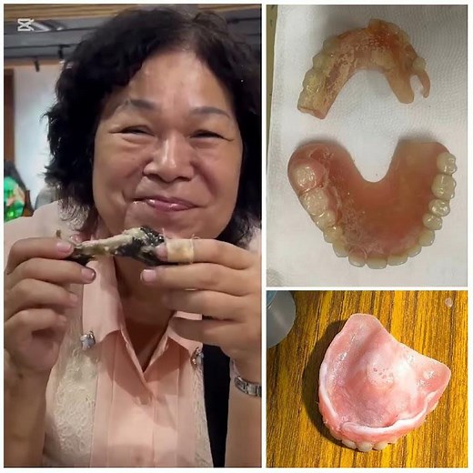 Tissue conditioning for treatment denture by Dr. Hongo