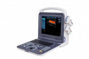 [Hot Item] Full Digital Color Doppler Ultrasound