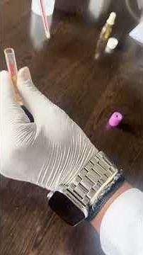 Hemoglobin Estimation by Sahli’s method