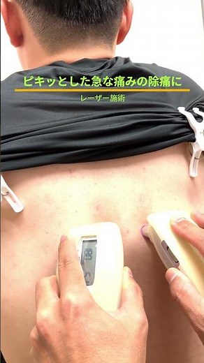 【ピキッとした痛みの除痛にレーザー施術】#ぎっくり背中,#ぎっくり腰,#北方はりきゅう接骨院
