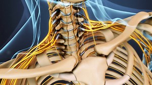 La enfermedad degenerativa del disco cervical