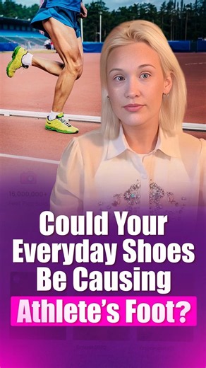 Your Sweaty Shoes Could Be Causing Athlete's Foot? #shorts #viral #feet #feetpic