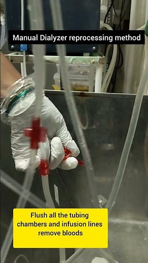 manual dialyzer reprocessing method/ reuse dialyzer cleaning #dialysis #dialysistechnician #medical