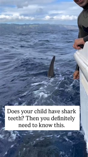 Gina| RDH, OMT|Tongue Tie| Sleep| Mouth Breathing & Airway Coach on Instagram: "This usually happens around age six 🗓️ — when kids start losing their baby teeth to make room for their permanent ones 🦷. But if the jaw hasn’t grown enough yet, there isn’t enough space… and the new teeth find a way anyway 😬. Crooked, twisted, or sneaking in behind the baby teeth — shark teeth! 🦈 If those baby teeth just won’t fall out, don’t wait 🚨. Early action can make all the difference: • ✅ Myofunctional A