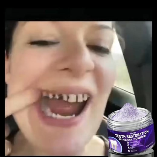 For thousands worldwide, BBOJI™ Teeth Restoration Mineral Powder has become the #1 dentist-endorsed alternative to costly and painful dental procedures. 🔬 Backed by the latest research in biomineralization, BBOJI™ works by replenishing lost minerals like calcium and phosphate — the same materials your teeth are made of — to: ✅ Dissolve stubborn tartar and plaque buildup ✅ Stop gum bleeding and inflammation ✅ Rebuild and strengthen enamel ✅ Whiten teeth naturally, without harsh chemicals 💬 “Aft