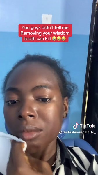 Wisdom Tooth Removal: My Painful Experience