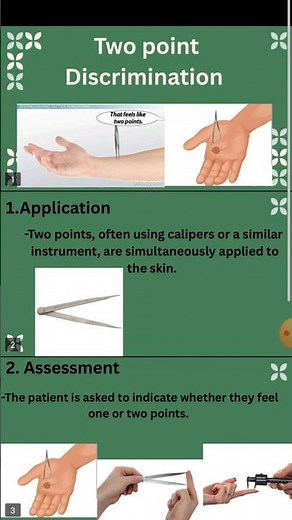 Two point discrimination Test.Cortical sensation test. #sensory #sensation #neuro #physiotherapy