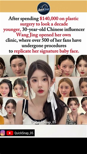 She Spent $140K on Plastic Surgery… Now 500 Fans Have Her Face 😳#china #plasticsurgery #truestory