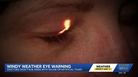 New Mexico wind gusts bring eye risks, doctors warn | Haystack News