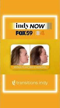 The 5 Most Common Causes of Female Hair Loss