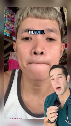 He superglued his mouth shut?!