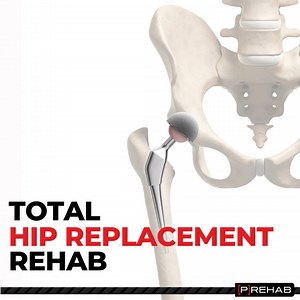 6.9K views · 70 reactions | Don't let your rehab from your total hip...