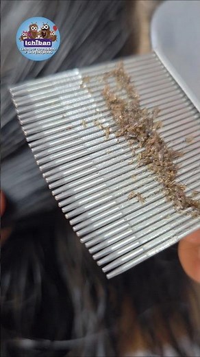 GIRL HAS HAD HER HEAD INFESTED WITH LICE FOR SEVERAL YEARS