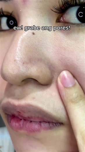 Transform Your Skin with G2G Exfo Pads Results