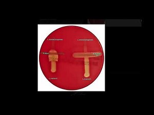 CAMP Listeria monocytogenes & Listeria ivanovii - Microbiology