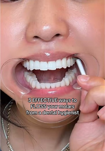 Flossing Techniques for Healthy Molars: A Guide