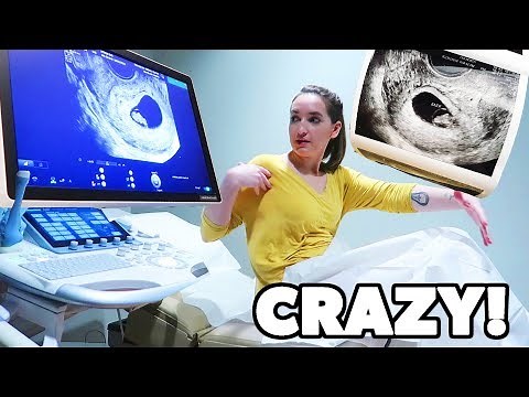 FIRST ULTRASOUND!! 8 WEEKS PREGNANT 👶🏻