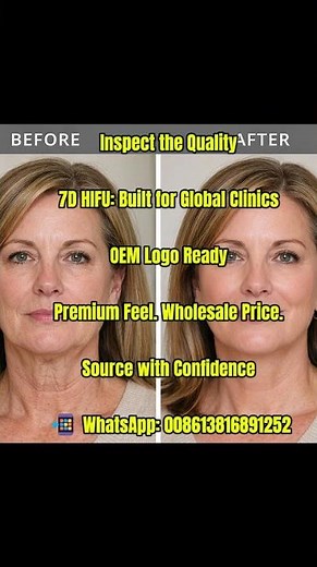 7D HIFU Before & After – Instant Face Lifting & Skin Tightening Results ✨
