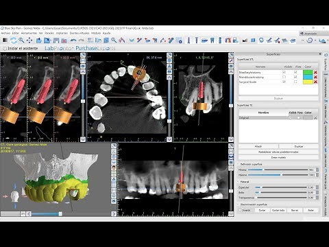 CERIK3D - VIVO Curso Guia Quirurgicas 3D en Blue Sky Bio Plan - Tutorial