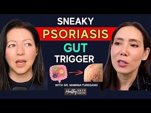 The Gut-Psoriasis Link: What Your Dermatologist Isn't Telling You | Dr. Mamina Turegano