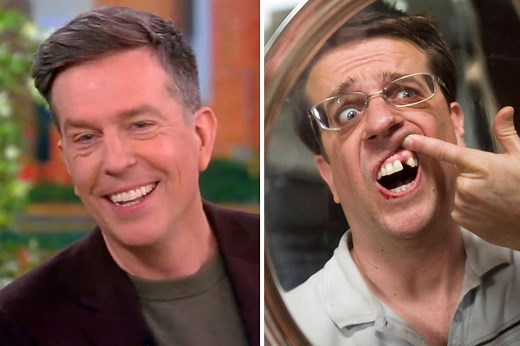 Ed Helms Shocks ‘The View’ With Reveal That His Missing Tooth In ‘The Hangover’ Was Real: “I Never Had An Adult Tooth Come Into That Spot”