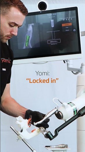 Drilling 4 osteotomies with Yomi S