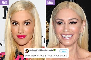 Gwen Stefani, 50, accused of getting plastic surgery as she looks 'unrecognizable' at the Grammys