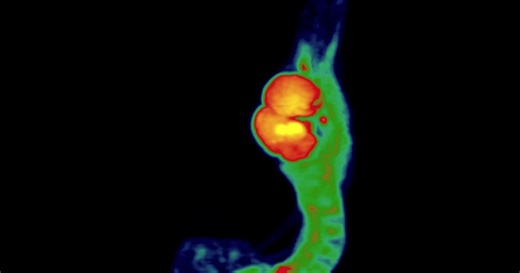 The Surprising Power of a Bird Brain