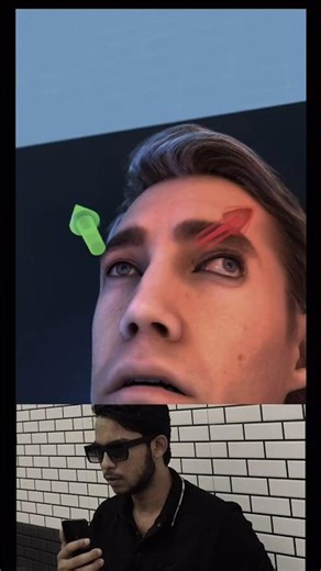 "Eye Alignment Treatment Explained" #viralshort #viral #viral#trending#crazy #animated#animation