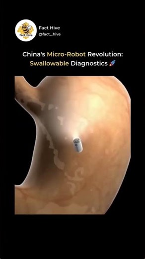 Redefining Medical Diagnostics! 💊 Meet the Capsule Endoscopy system