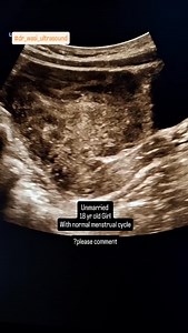 Uterus ultrasound #dr_wasi_ultrasound #ultrasonography #radiologist #neetpg #medicaleducation #abdominalultrasound #ultrasounds #medicalimaging | Ultrasound made easy