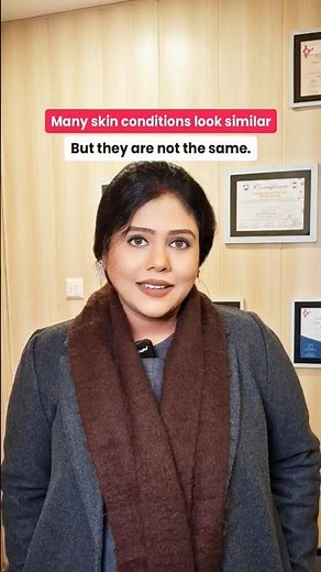 Freckles vs Melasma vs Viral Warts | Same Dikhe, Treatment Alag! | Dermatologist Explains